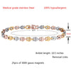 USWEL Magnetic Anklet Bracelets for Women, Anti Swelling Obsidian Anklet,Magnetic Lymph Detox Bracelet for Women